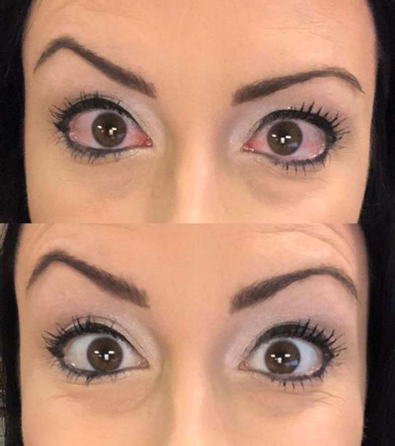 Vision Enhance Roller Kenzymart vision-enhance-roller-kenzymart