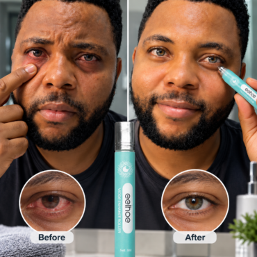 Vision Enhance Roller